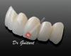 Dr Guitart- Clinica dental Implantologia